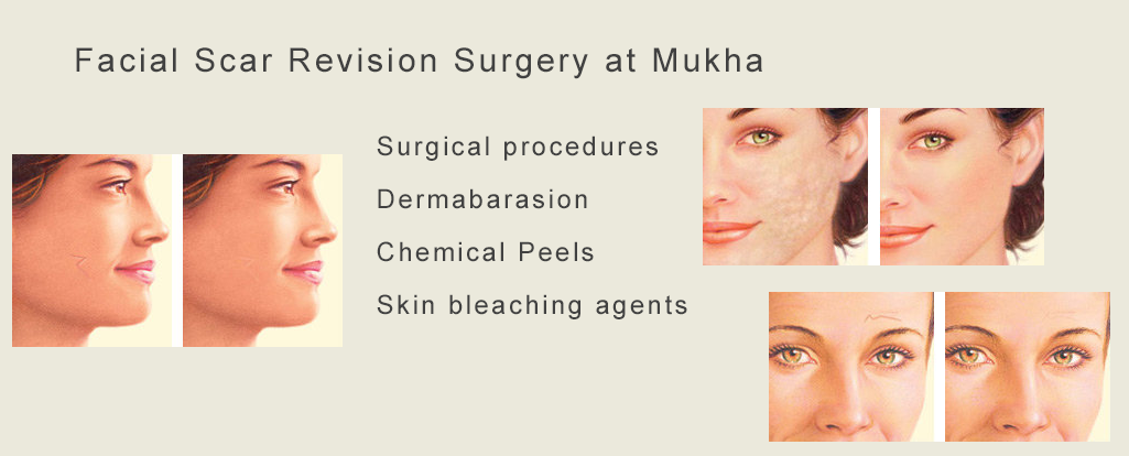 Mukha Facial Surgery & Dental Implant Center